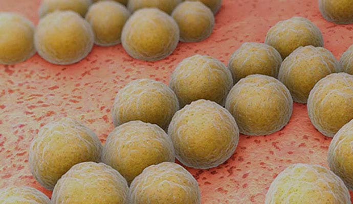 MRSA bacteria cells viewed under a microscope